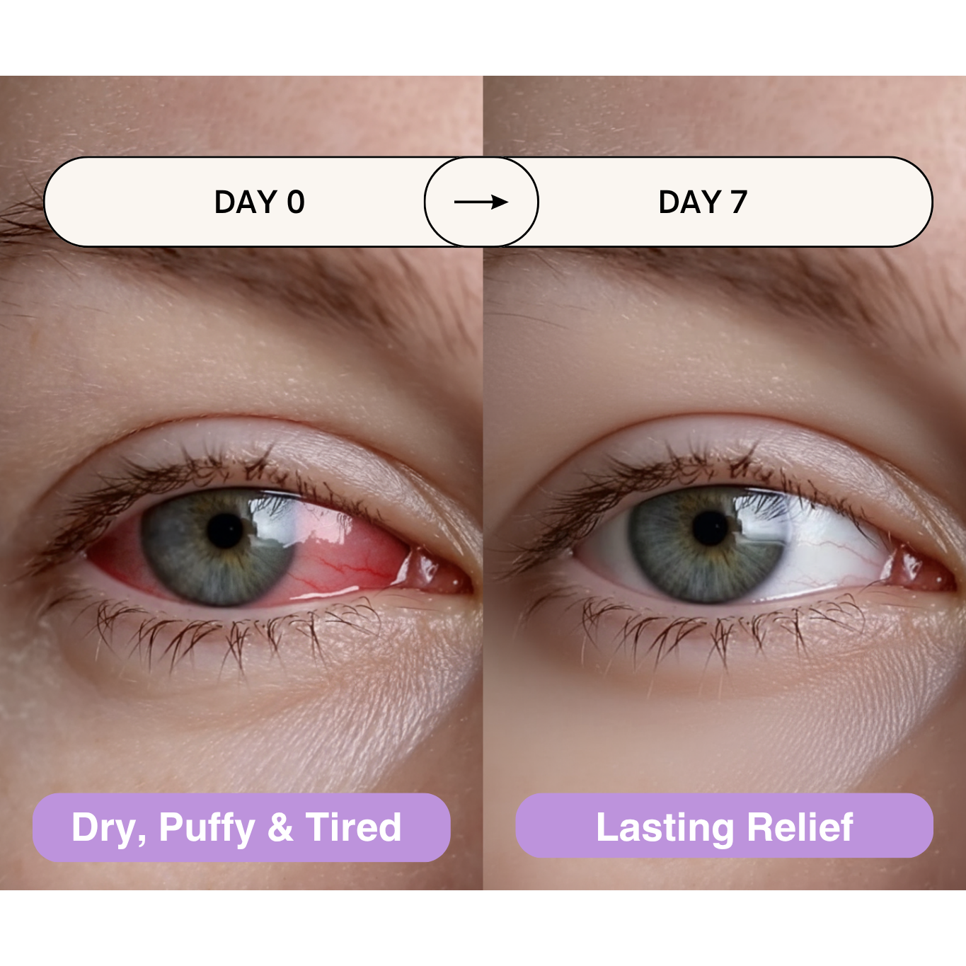 VapoCalm - Steam Eye Mask